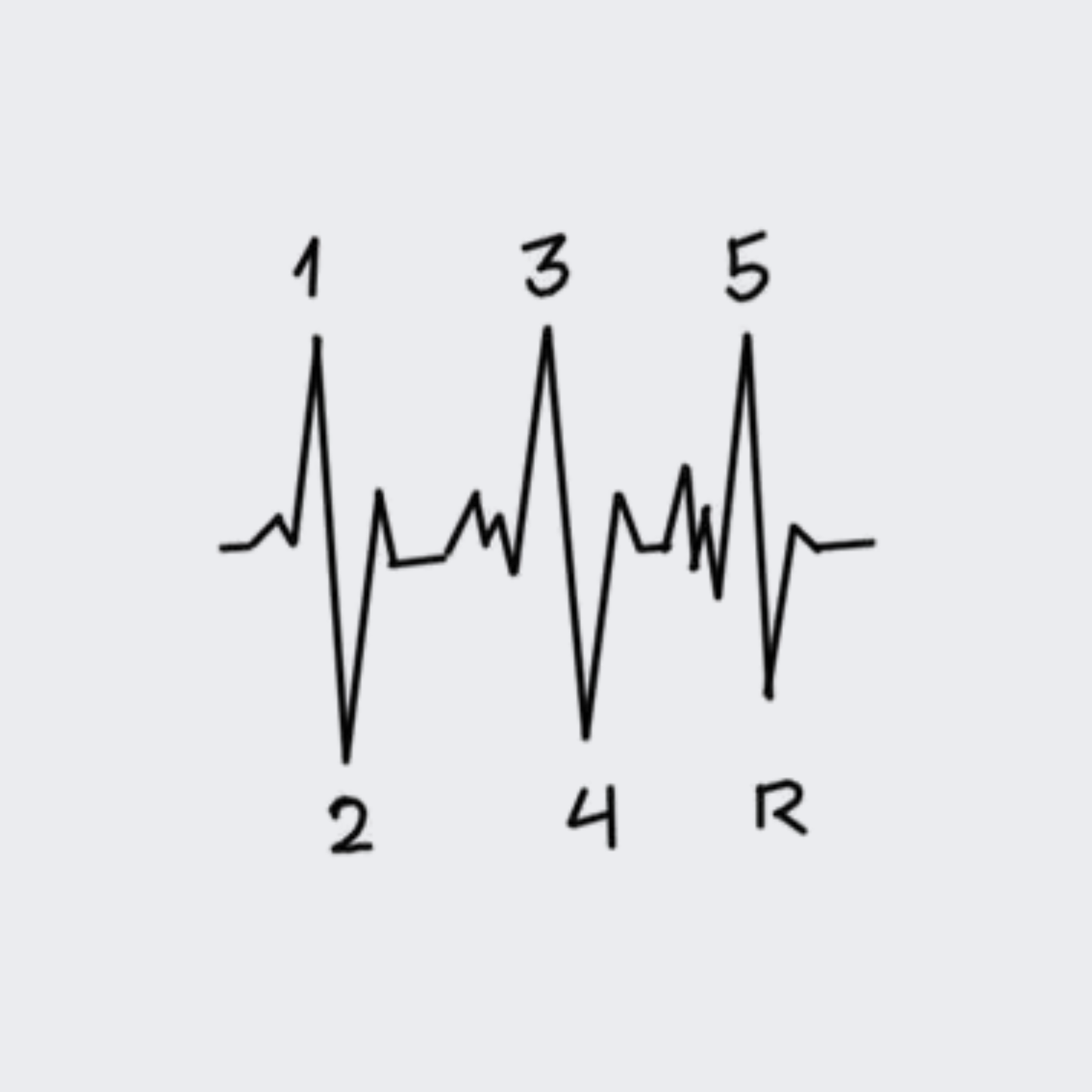 Transmission Heartbeat